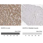 Atlas Antibodies Anti-ACAT2 Antibody