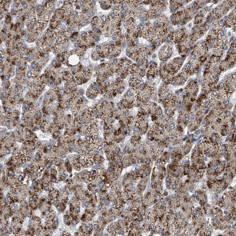 Atlas Antibodies Anti-ACBD4 Antibody