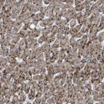 Atlas Antibodies Anti-ACBD4 Antibody
