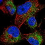 Atlas Antibodies Anti-ACBD7 Antibody