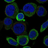 Atlas Antibodies Anti-ACCSL Antibody