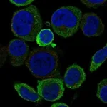 Atlas Antibodies Anti-ACCSL Antibody