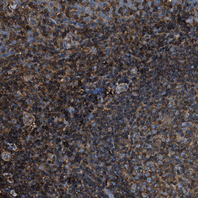 Atlas Antibodies Anti-ACCS Antibody