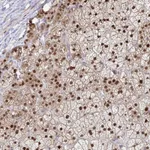 Atlas Antibodies Anti-ACD Antibody