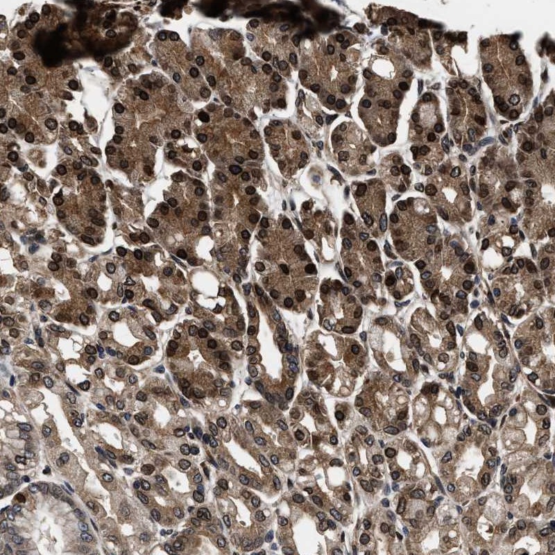 Atlas Antibodies Anti-ACCS Antibody