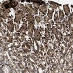 Atlas Antibodies Anti-ACCS Antibody