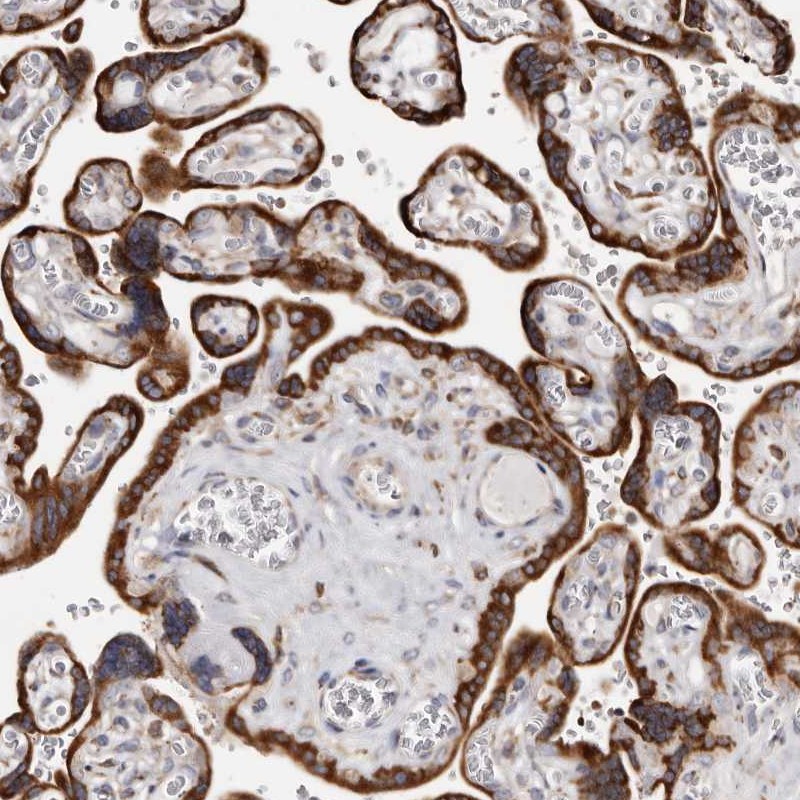 Atlas Antibodies Anti-ACBD6 Antibody