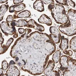 Atlas Antibodies Anti-ACBD6 Antibody