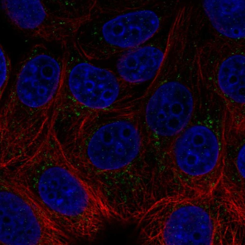 Atlas Antibodies Anti-ACHE Antibody