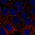 Atlas Antibodies Anti-ACHE Antibody