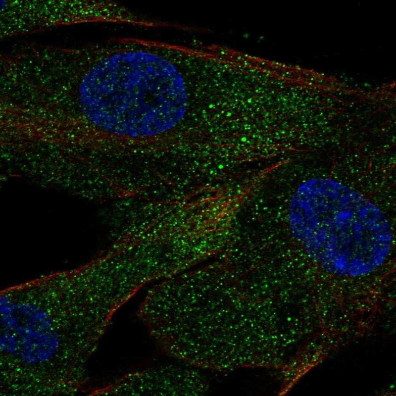 Atlas Antibodies Anti-ACE Antibody