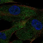 Atlas Antibodies Anti-ACE Antibody