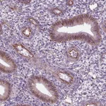 Atlas Antibodies Anti-ACER3 Antibody
