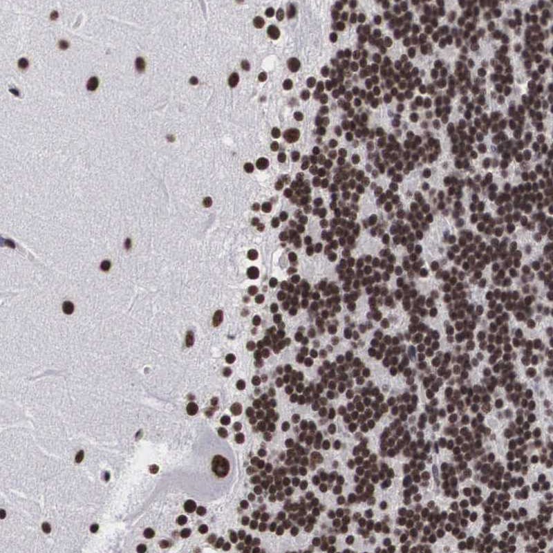 Atlas Antibodies Anti-ACIN1 Antibody