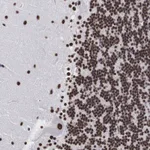 Atlas Antibodies Anti-ACIN1 Antibody