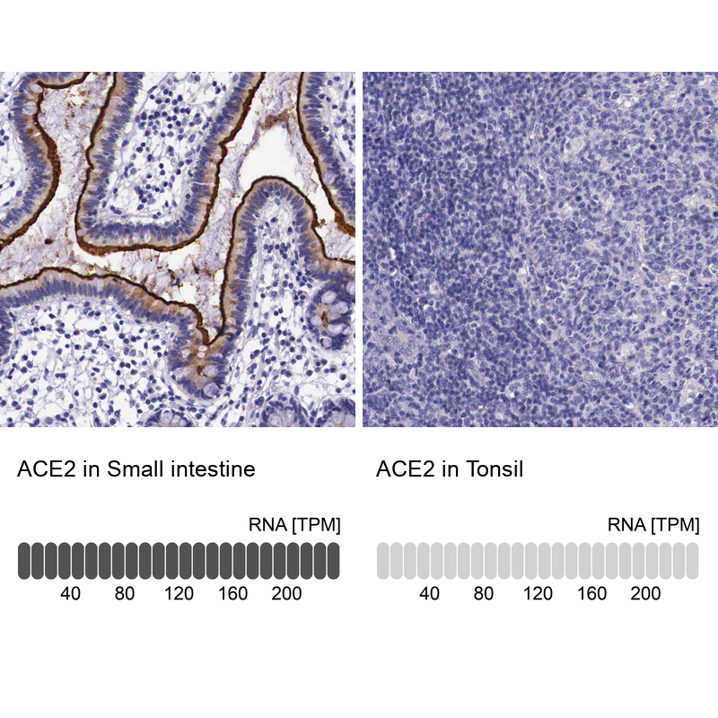 Atlas Antibodies Anti-ACE2 Antibody