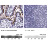 Atlas Antibodies Anti-ACE2 Antibody
