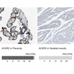 Atlas Antibodies Anti-ACKR2 Antibody