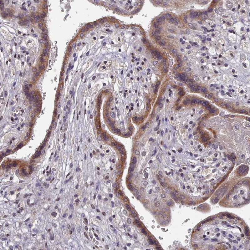 Atlas Antibodies Anti-ACKR3 Antibody