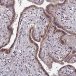 Atlas Antibodies Anti-ACKR3 Antibody