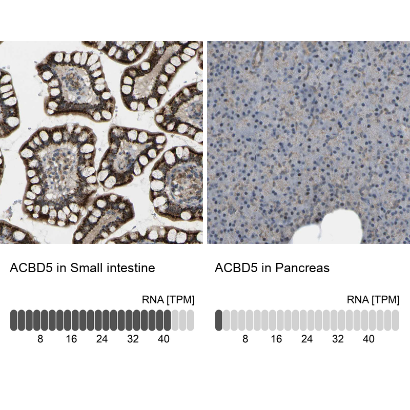 Atlas Antibodies Anti-ACBD5 Antibody