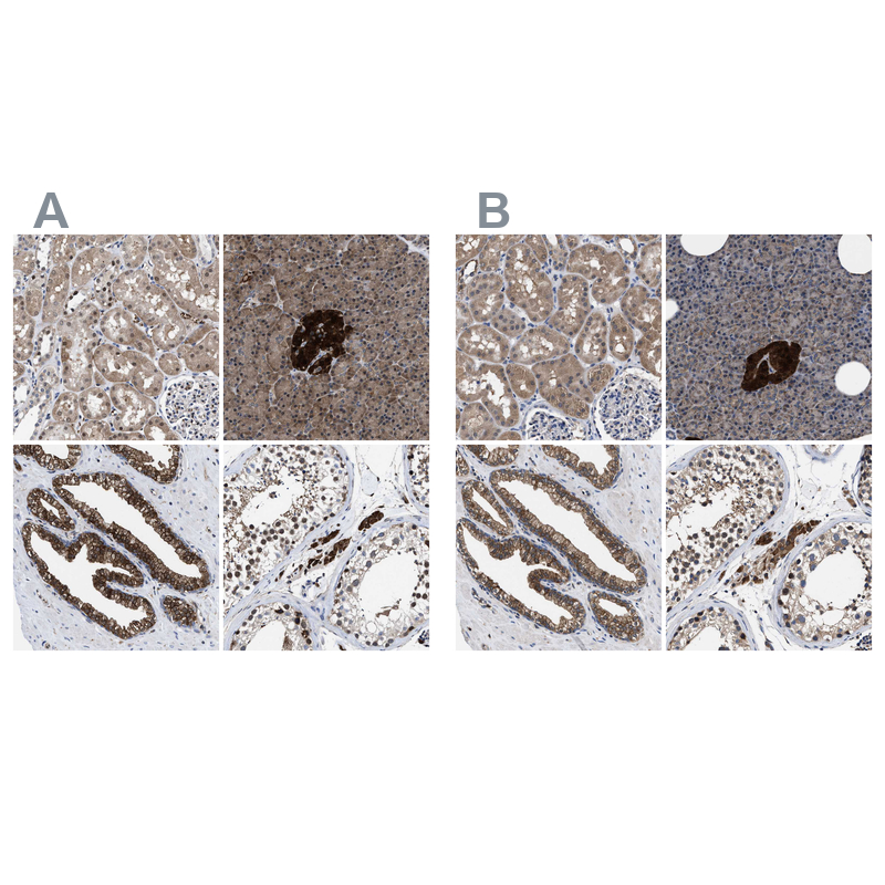 Atlas Antibodies Anti-ACLY Antibody