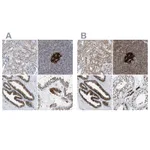 Atlas Antibodies Anti-ACLY Antibody