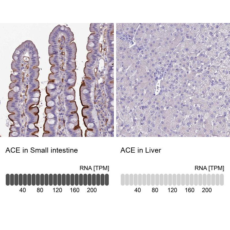 Atlas Antibodies Anti-ACE Antibody