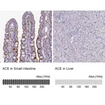 Atlas Antibodies Anti-ACE Antibody