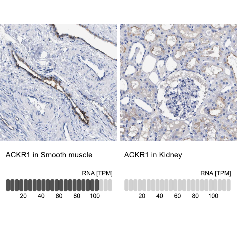 Atlas Antibodies Anti-ACKR1 Antibody