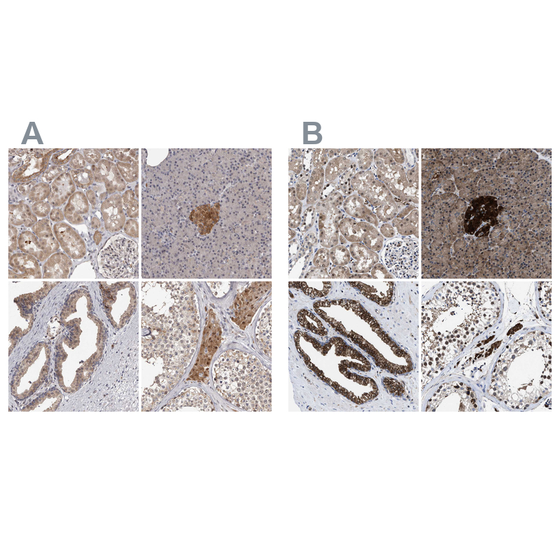 Atlas Antibodies Anti-ACLY Antibody