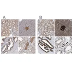 Atlas Antibodies Anti-ACLY Antibody