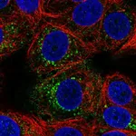 Atlas Antibodies Anti-ACBD7 Antibody