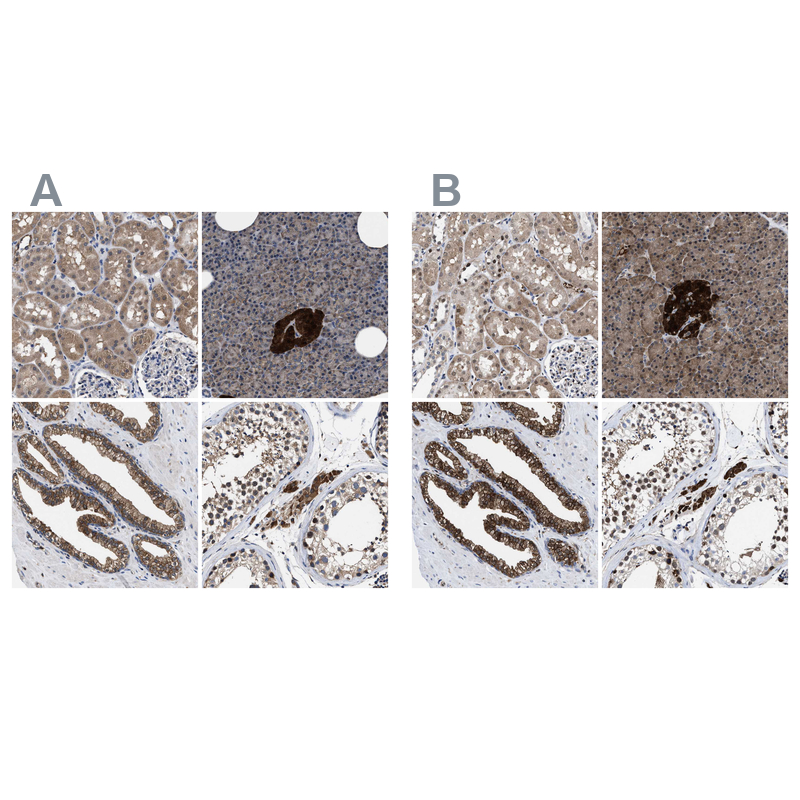 Atlas Antibodies Anti-ACLY Antibody