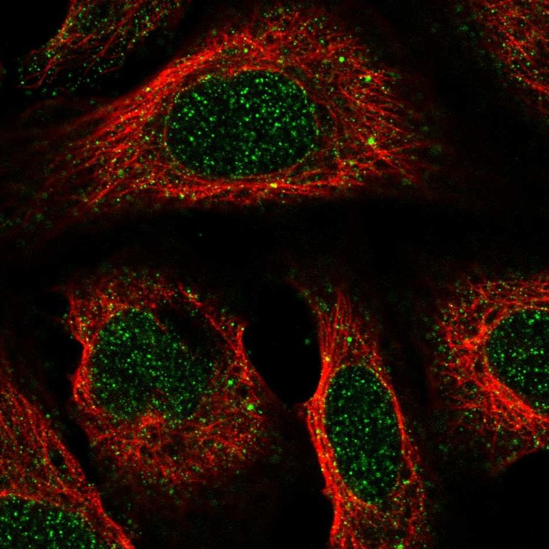 Atlas Antibodies Anti-ACKR2 Antibody