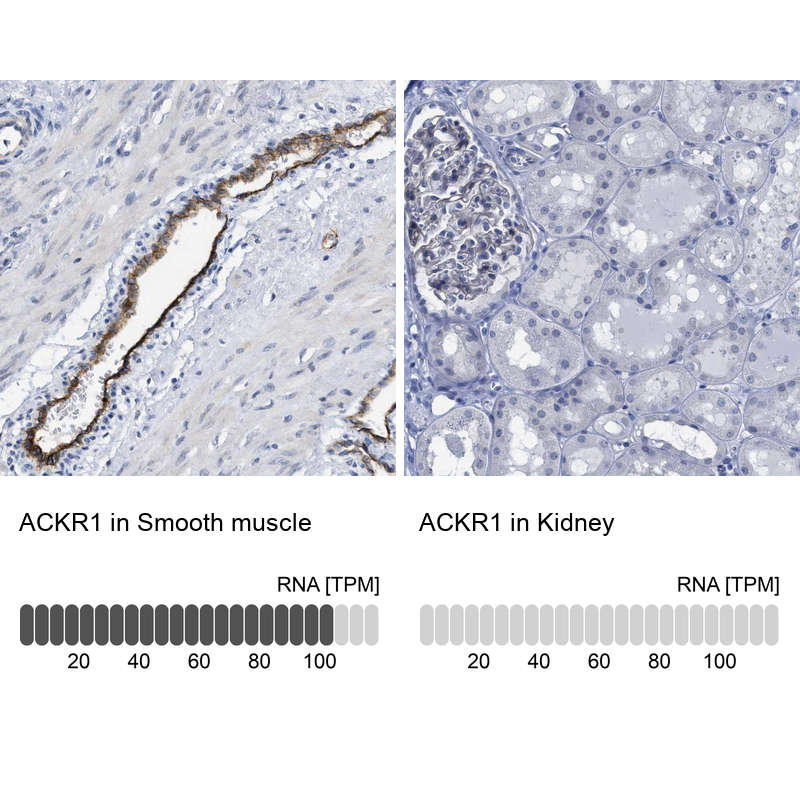 Atlas Antibodies Anti-ACKR1 Antibody