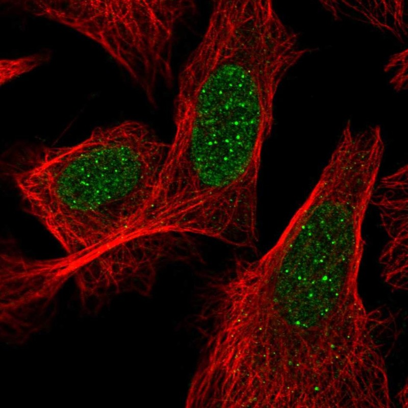 Atlas Antibodies Anti-ACD Antibody
