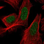 Atlas Antibodies Anti-ACD Antibody