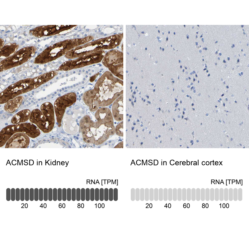 Atlas Antibodies Anti-ACMSD Antibody