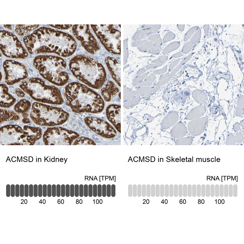 Atlas Antibodies Anti-ACMSD Antibody