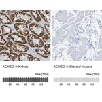 Atlas Antibodies Anti-ACMSD Antibody