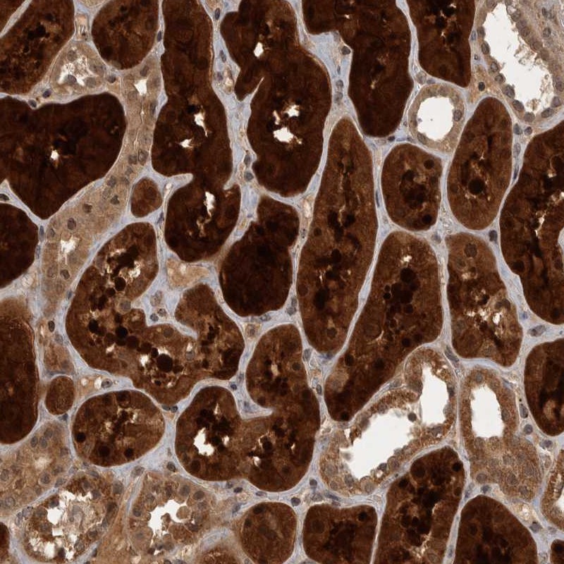 Atlas Antibodies Anti-ACO1 Antibody