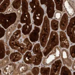 Atlas Antibodies Anti-ACO1 Antibody