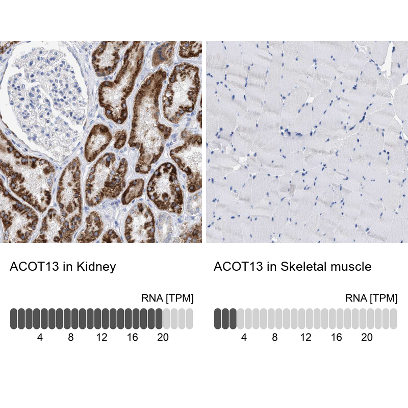 Atlas Antibodies Anti-ACOT13 Antibody
