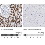 Atlas Antibodies Anti-ACOT13 Antibody