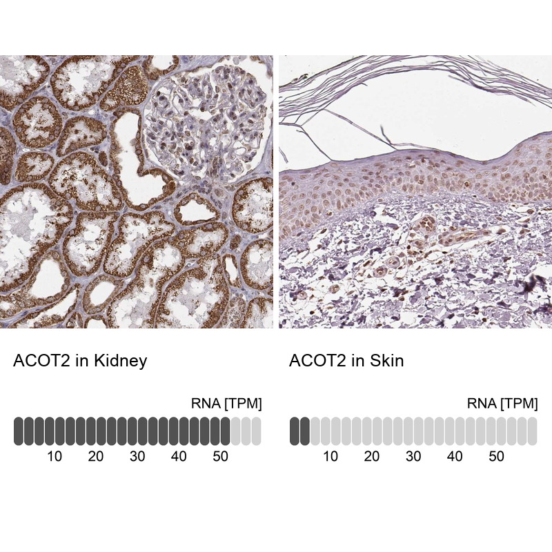 Atlas Antibodies Anti-ACOT2 Antibody