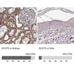 Atlas Antibodies Anti-ACOT2 Antibody