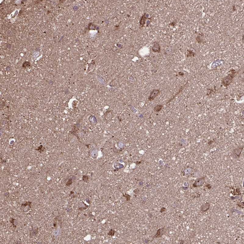 Atlas Antibodies Anti-ACOT6 Antibody