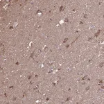 Atlas Antibodies Anti-ACOT6 Antibody