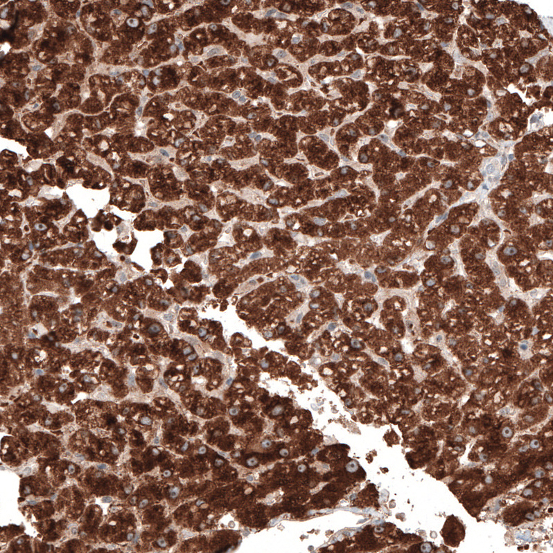 Atlas Antibodies Anti-ACOT4 Antibody